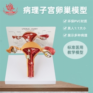 人体女性模型病理子宫生殖科妇产科医患沟通病理阴道卵巢教学教具