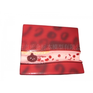 供应血管模型-病理模型.教学.解剖.医学模型