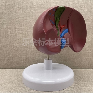 厂家供应ZM2025肝及病态胆囊模型生物教学模型带底座医患交流模型