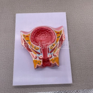 厂家供应Z1092女性盆部经膀胱冠状切模型生物教学模型带底座