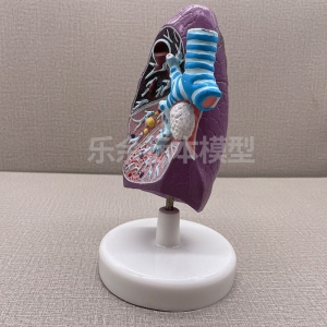 厂家供应ZM2013肺 病理模型生物教学模型带底座医患交流模型现货