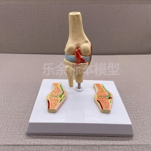 厂家供应ZM2085风温性关 节炎模型生物教学模型带底座医患交流模