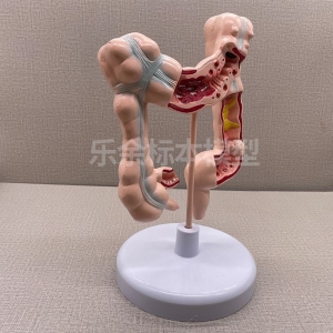 供应ZM2004结肠、直肠常见病模型生物教学模型带底座医患交流模型