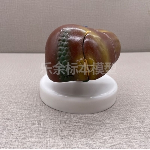 厂家供应ZM2024肝脏病理模型生物教学模型带底座医患交流模型现货