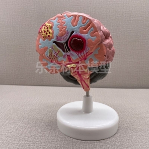 供应ZM2029脑 中风模型生物教学模型带底座医患交流模型现货