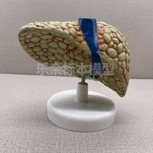 供应ZM2024弥漫性肝 病变模型生物教学模型带底座医患交流模型
